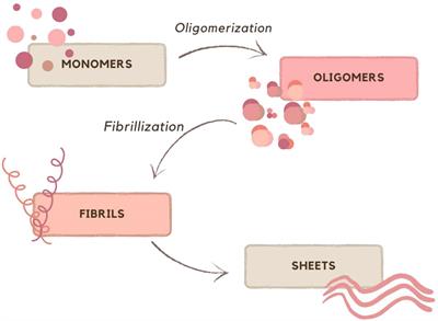 Amyloid, Crohn’s disease, and Alzheimer’s disease - are they linked?